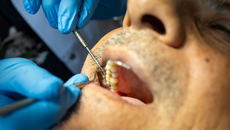 Periodontoloji Nedir? | Düzce diş kliniği | İmge Dental